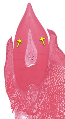 Gingiva1-2_E
