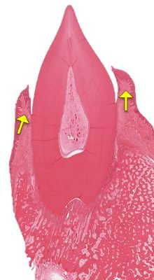 Gingiva1-4