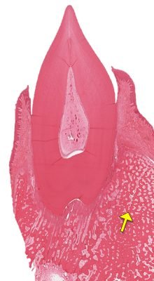 Gingiva1-5