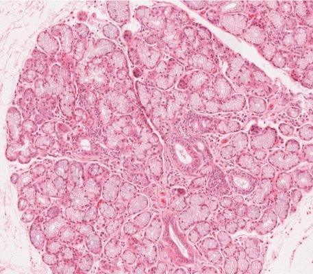 Salivary Gland1-1