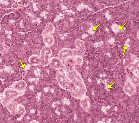 Salivary Gland4-2