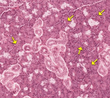 Salivary Gland4-3