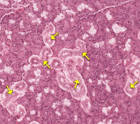 Salivary Gland4-4