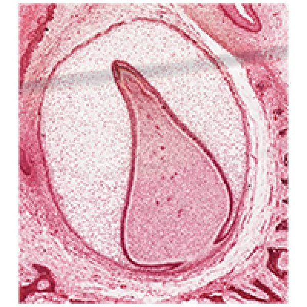 Tooth Development