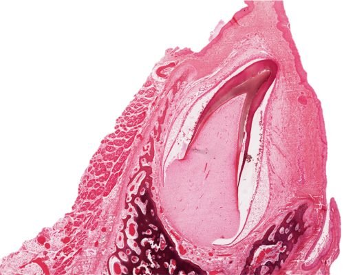 Tooth Development2-1