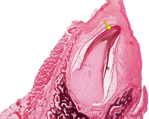 Tooth Development2-2