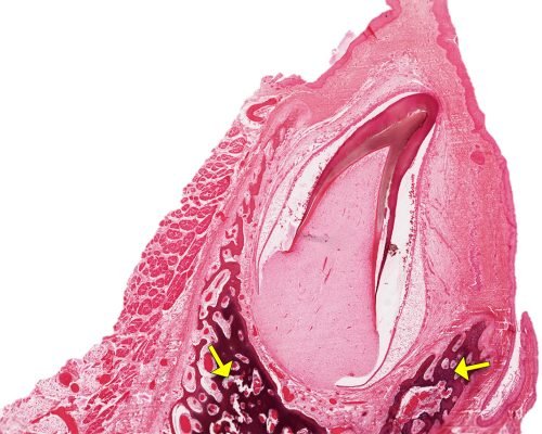 Tooth Development2-7