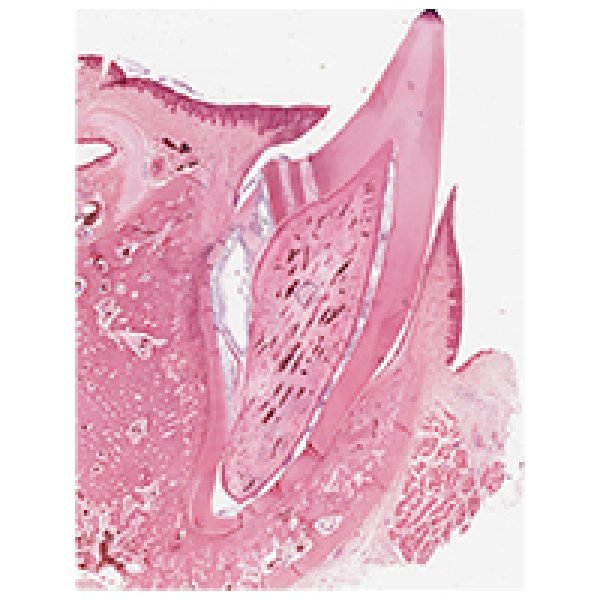 Tooth Eruption