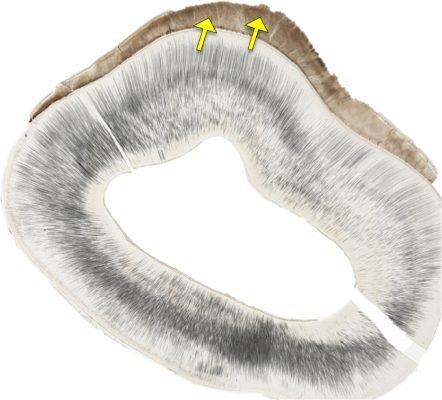 Tooth-Structure2_E