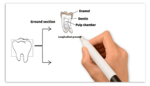 Whiteboard animation_FigureB